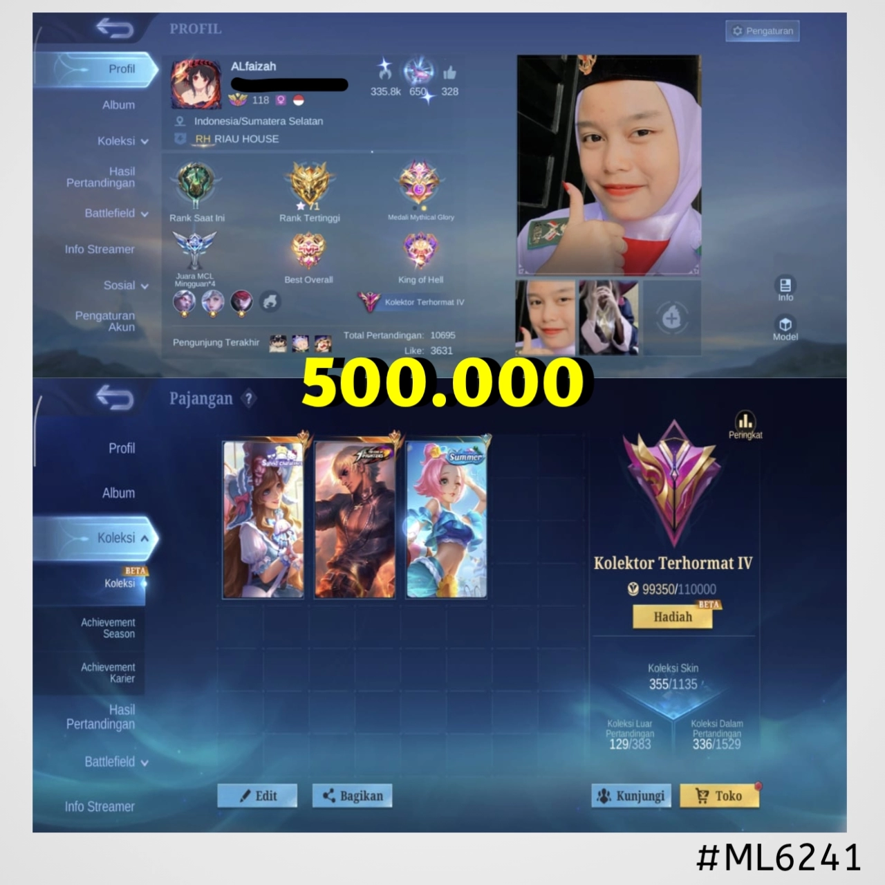 STOK ML #ML6241