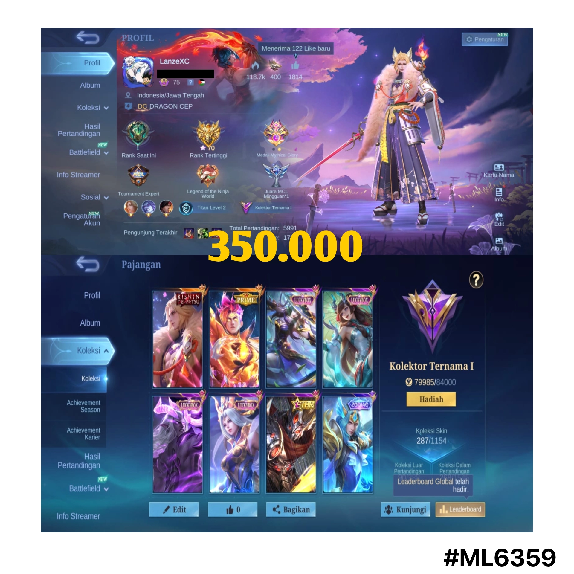 STOK ML #ML6359
